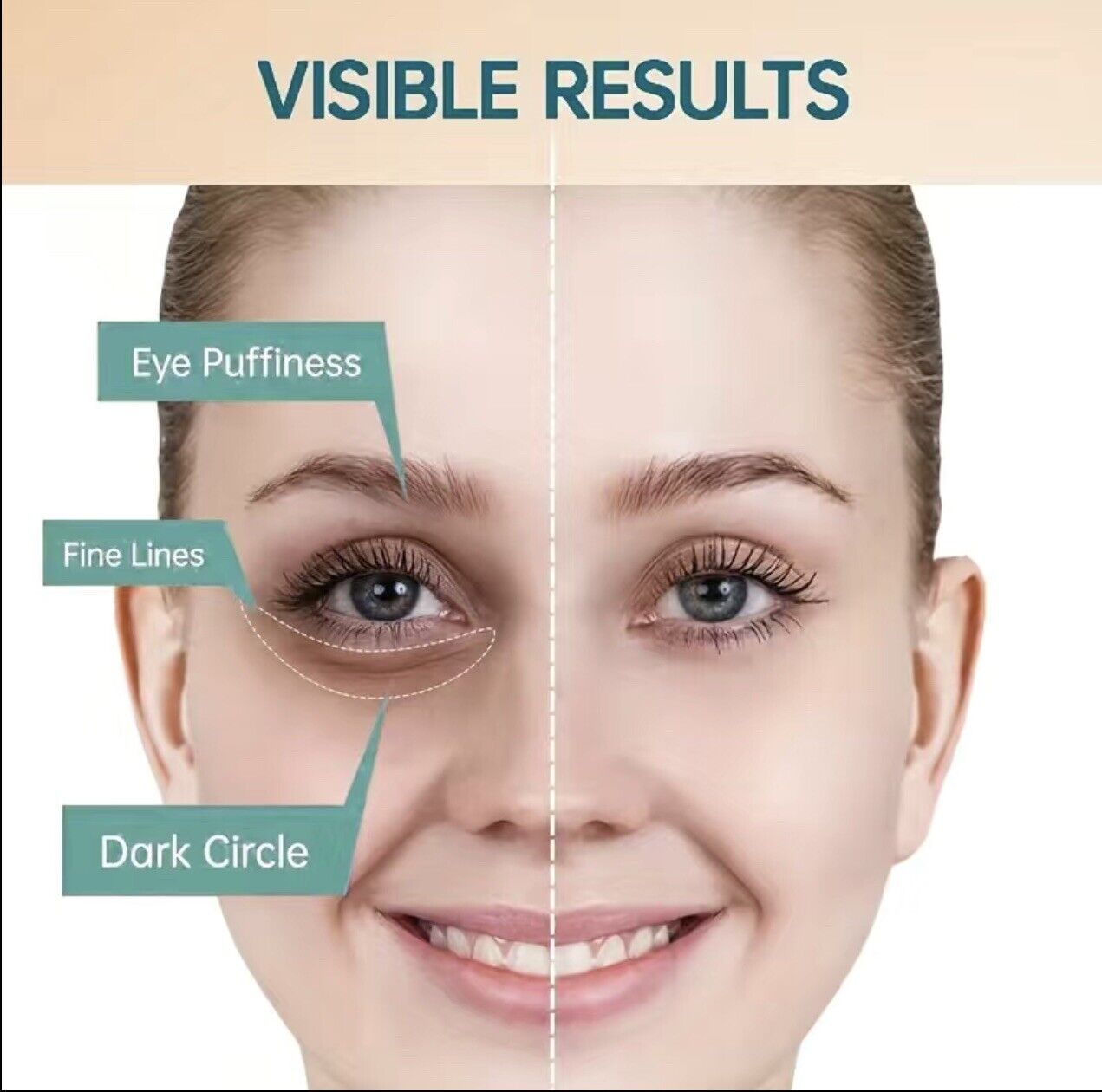 Dark Eye Circle - Rejuvenating Anti Ageing Serum Face Eye Cream For Wrinkles