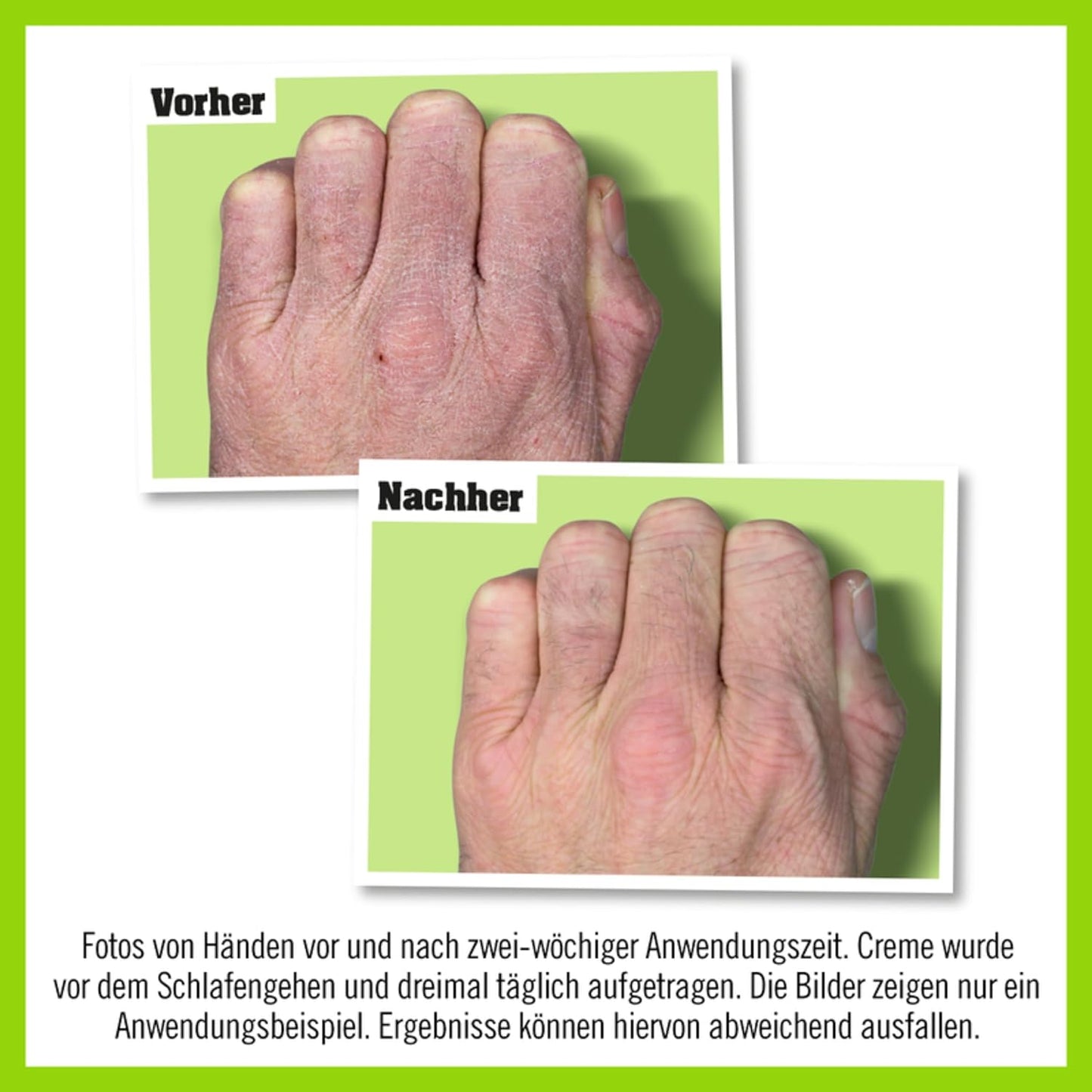 O’Keeffe’s Working Hands, 96g Jar - Hand Cream for Extremely Dry, Cracked Hands | Instantly Boosts Moisture Levels, Creates a Protective Layer & Prevents Moisture Loss