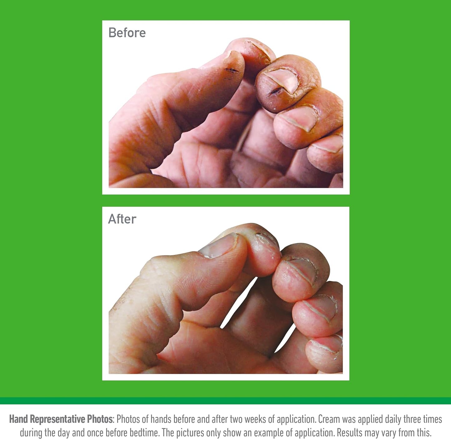 O’Keeffe’s Working Hands, 96g Jar - Hand Cream for Extremely Dry, Cracked Hands | Instantly Boosts Moisture Levels, Creates a Protective Layer & Prevents Moisture Loss