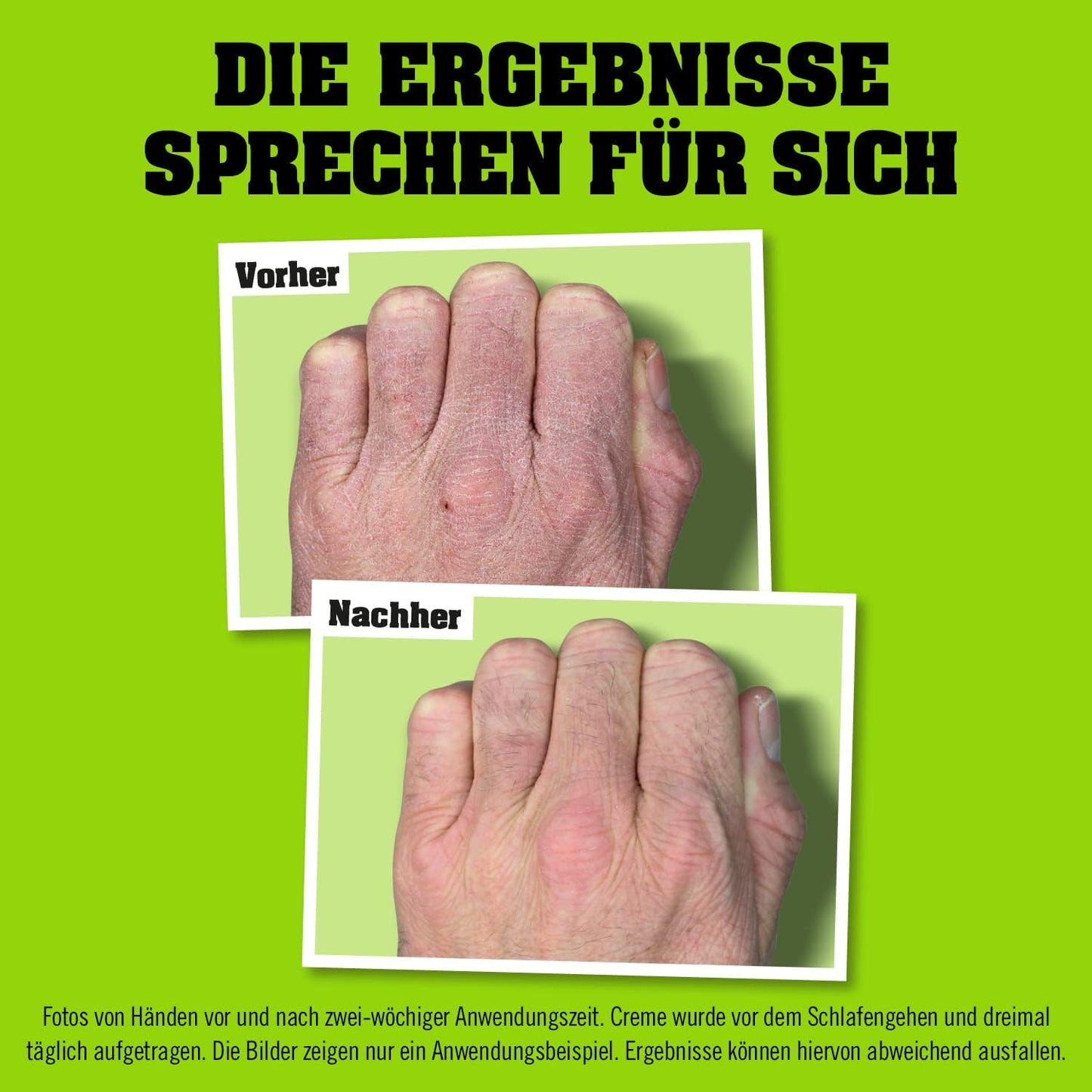 O’Keeffe’s Working Hands, 96g Jar - Hand Cream for Extremely Dry, Cracked Hands | Instantly Boosts Moisture Levels, Creates a Protective Layer & Prevents Moisture Loss