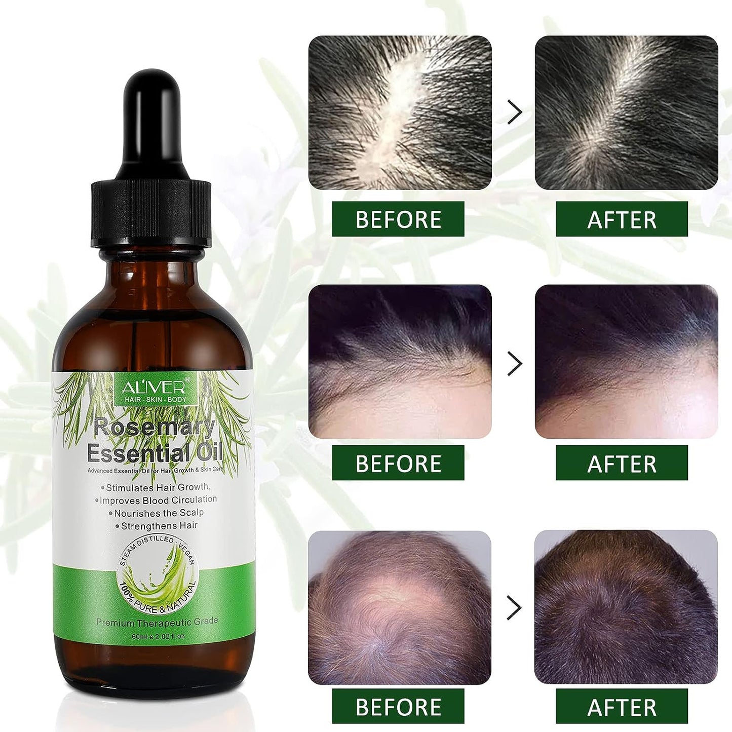 Rosemary Oil for Hair Growth & Skin Care - 100% Pure Rosemary Essential Oil