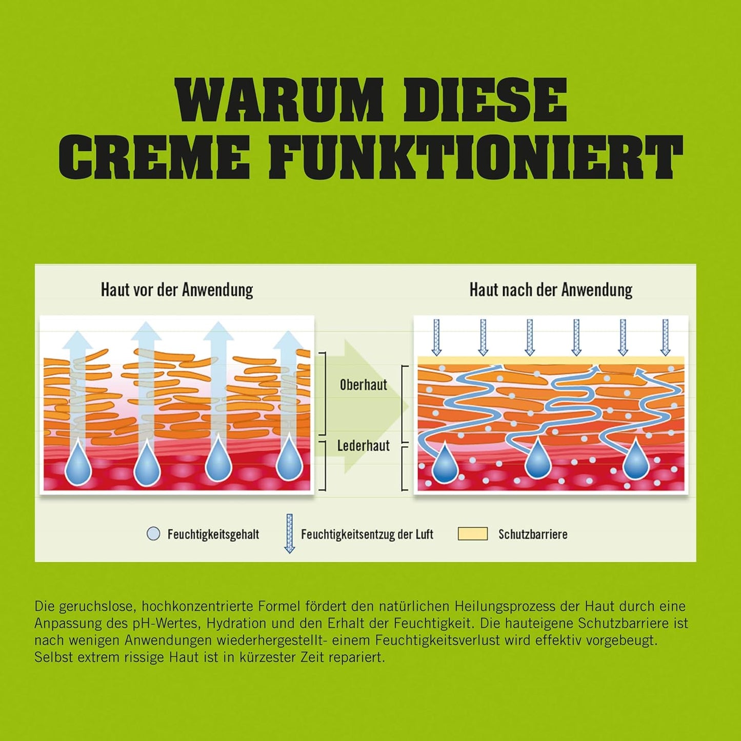 O’Keeffe’s Working Hands, 96g Jar - Hand Cream for Extremely Dry, Cracked Hands | Instantly Boosts Moisture Levels, Creates a Protective Layer & Prevents Moisture Loss