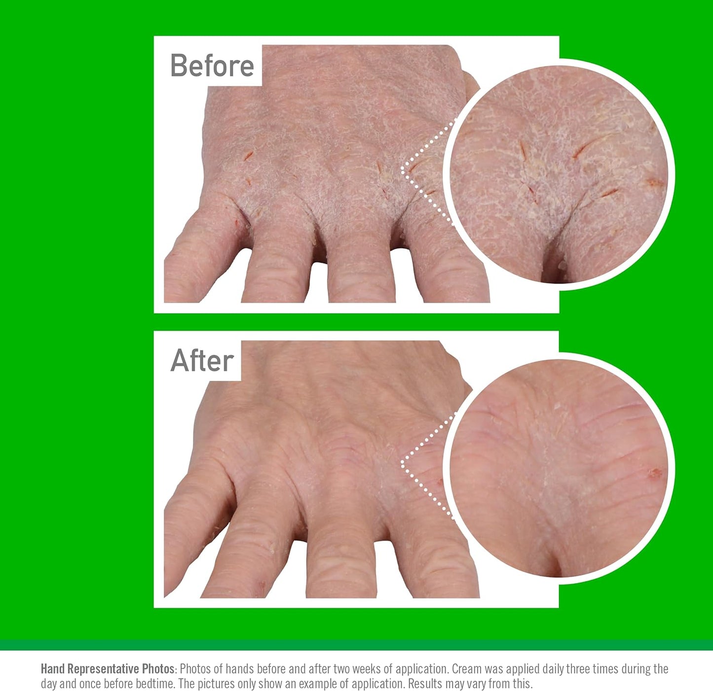 O’Keeffe’s Working Hands, 96g Jar - Hand Cream for Extremely Dry, Cracked Hands | Instantly Boosts Moisture Levels, Creates a Protective Layer & Prevents Moisture Loss