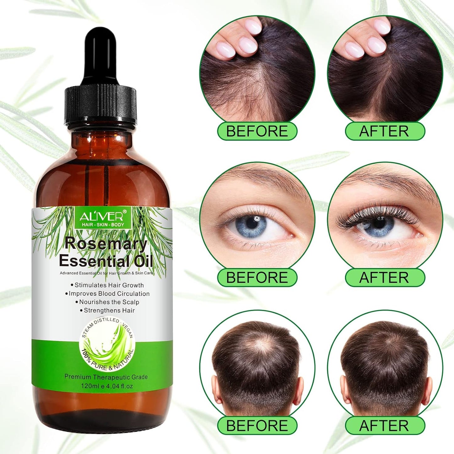 Rosemary Oil for Hair Growth & Skin Care - 100% Pure Rosemary Essential Oil